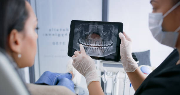 Licensed Teeth Whitening service in West Bountiful, UT - Smile Center Dentistry